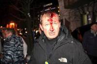 Медслужба Майдана заявляет, что во время сегодняшних столкновений получили ранения уже 30 активистов